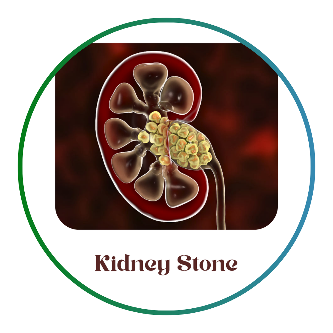 Add a subheading (1)