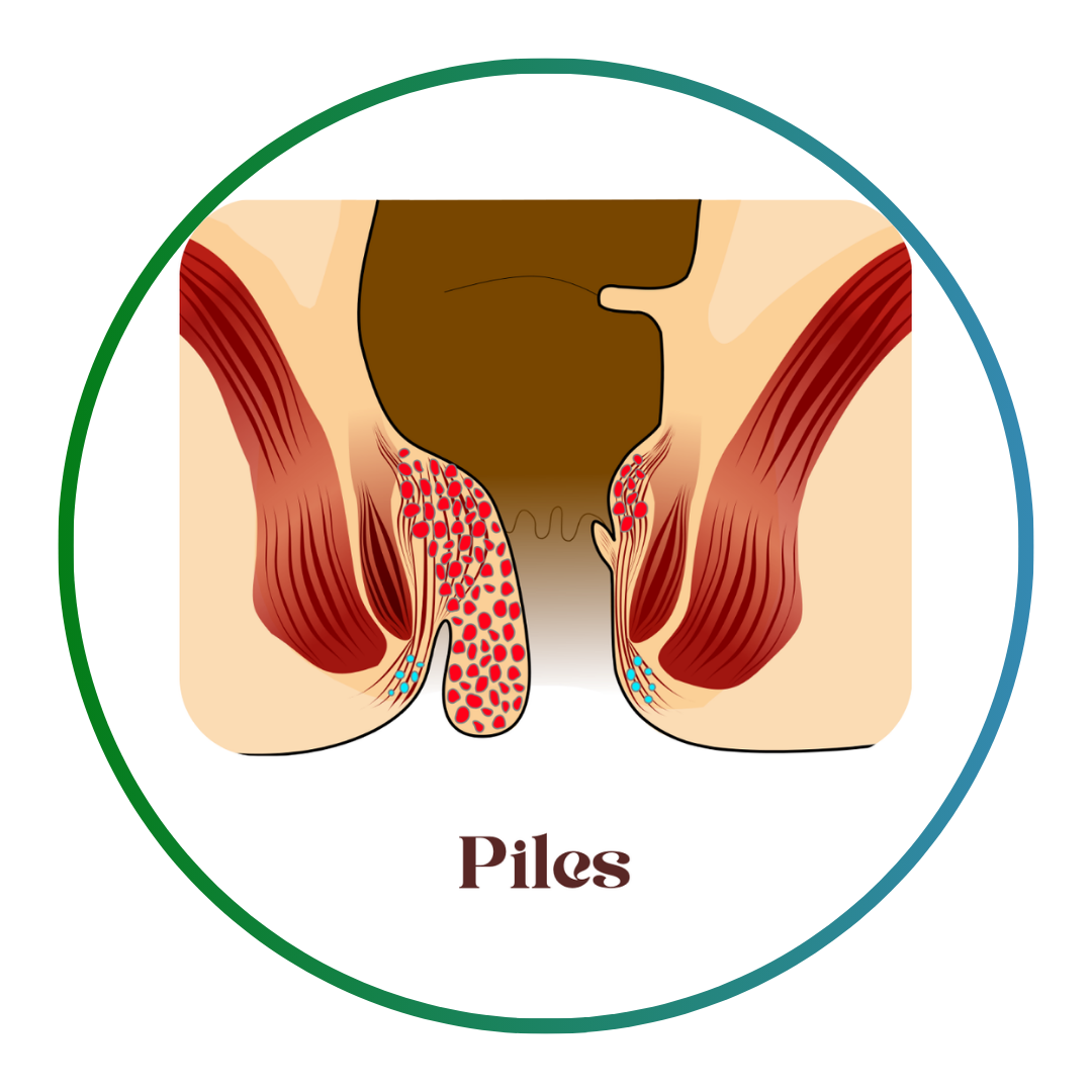 Add a subheading (3)