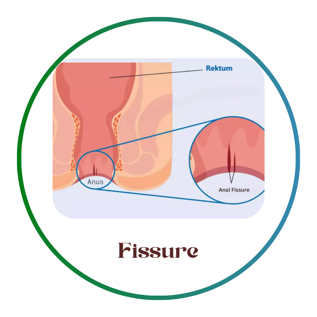 Add a subheading (4)