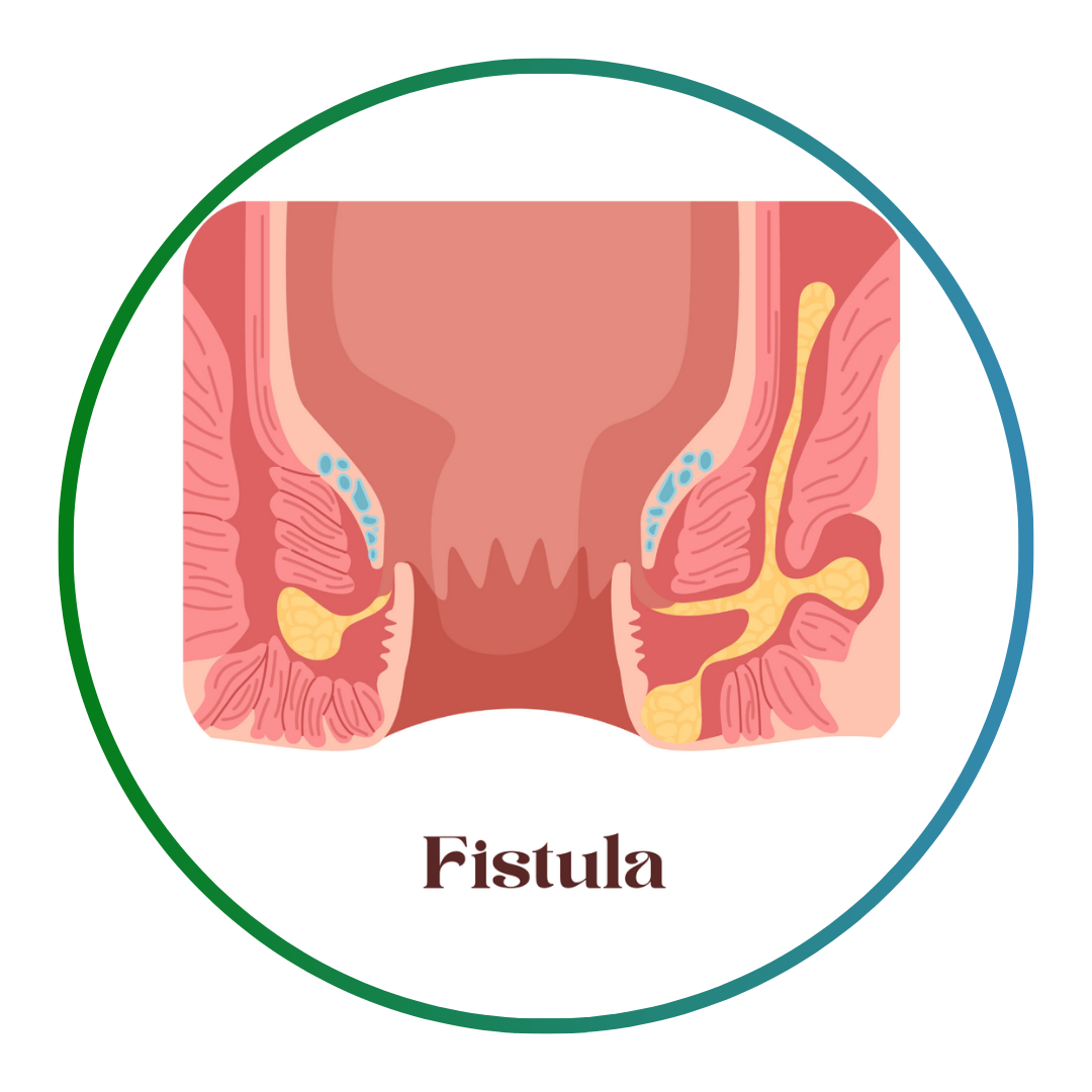 Add a subheading (5)